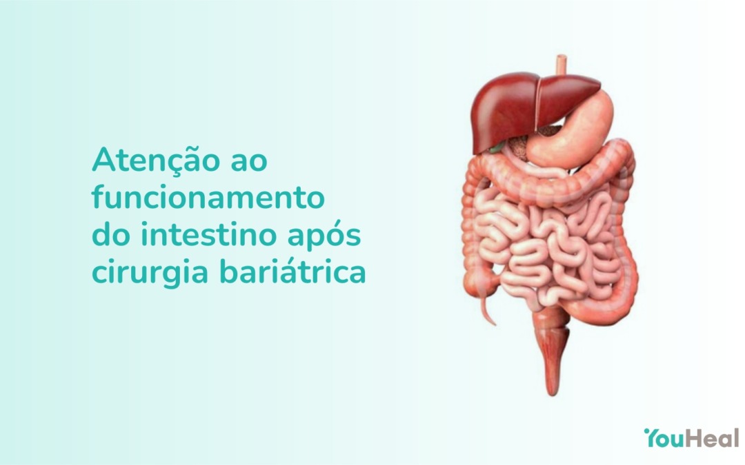 Atenção ao funcionamento do intestino após cirurgia bariátrica