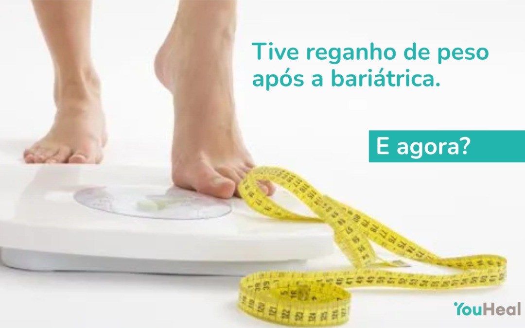 Tive reganho de peso após a bariátrica. E agora?