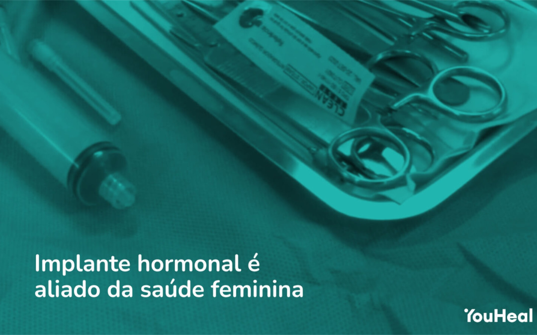 Implante hormonal é aliado da saúde feminina Clínica You Heal