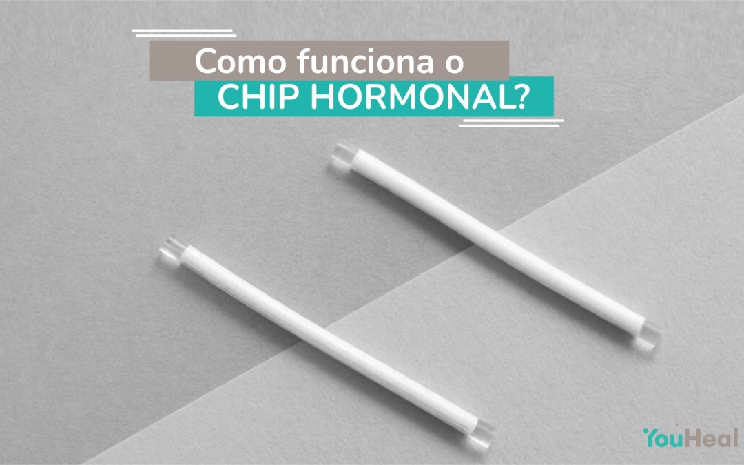 Como funciona o chip hormonal?